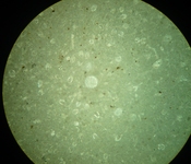 Calpionelles